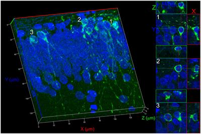 Physical Exercise Restores the Generation of Newborn Neurons in an Animal Model of Chronic Epilepsy